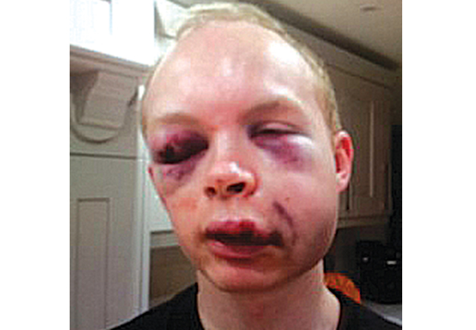 Police seeks witnesses to brutal assault Callum Wade