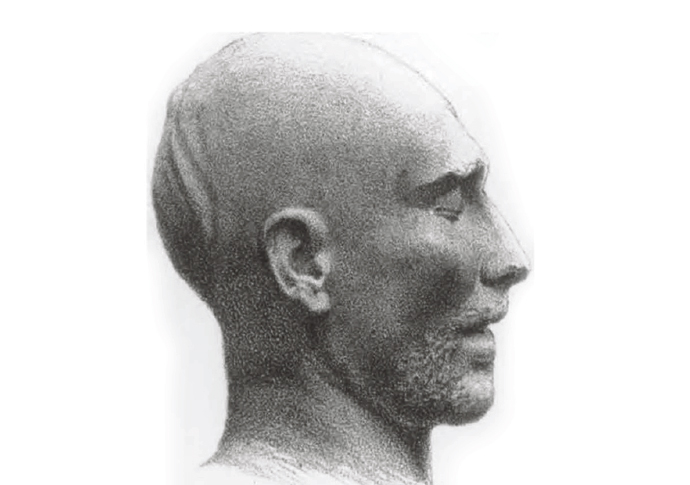 Barthelemy Death (drawing) from July 1855 issue of 'The Zoist'