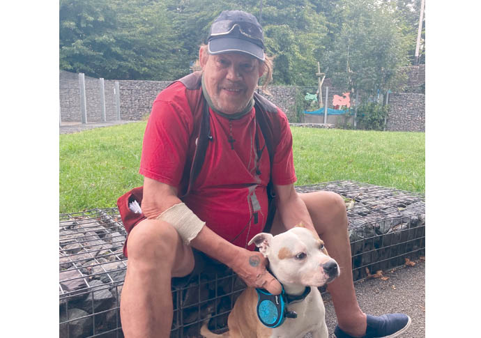 Dog attack victim has lost a finger AJ Bailey