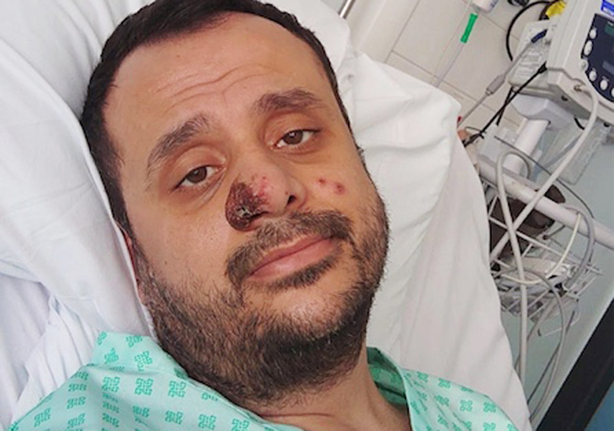 ‘Monkeypox patients continue to work for fear of losing their job’ Harun Tulunay