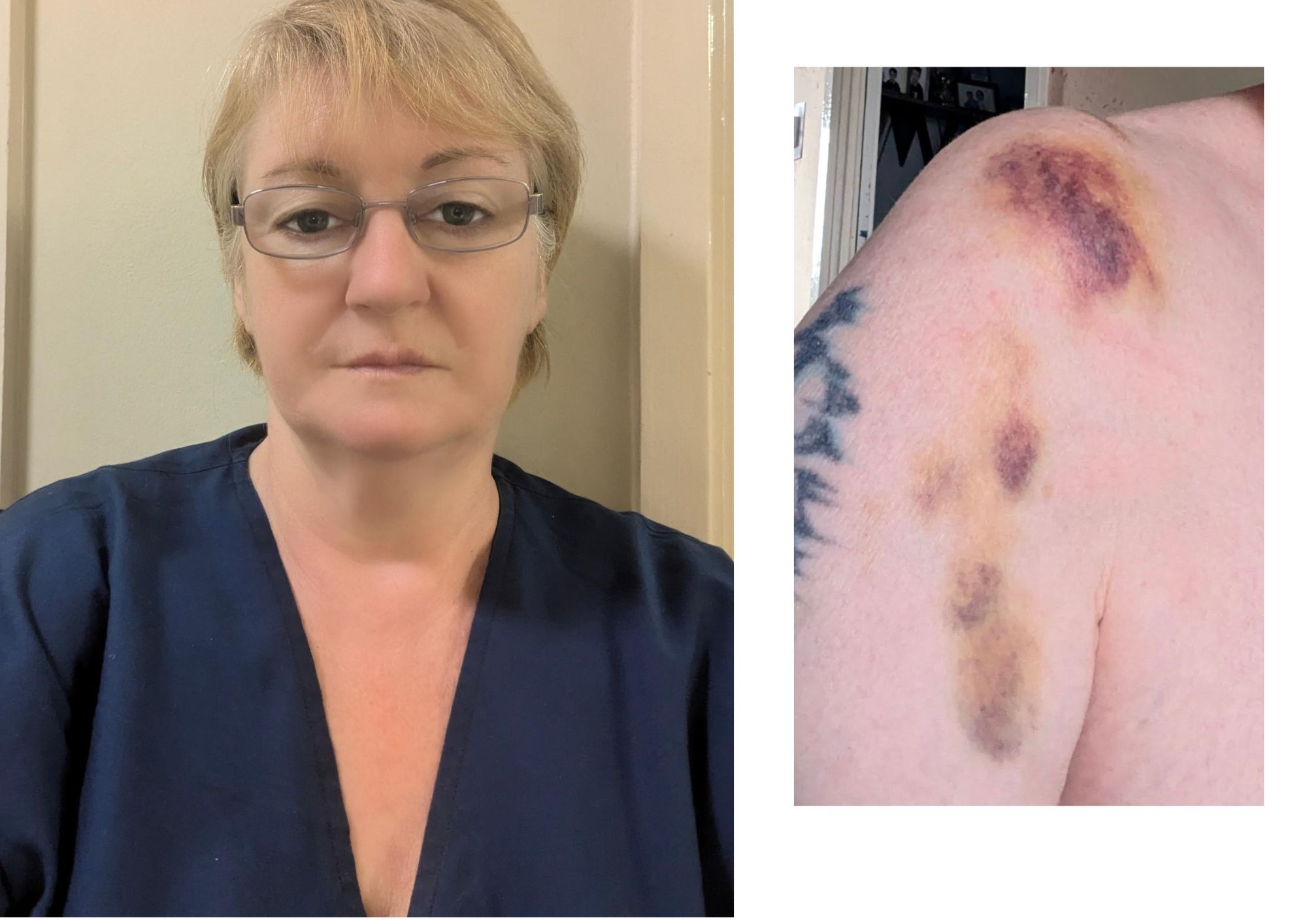 ‘I broke my ankle when the braking bus sent me flying’ bus stop