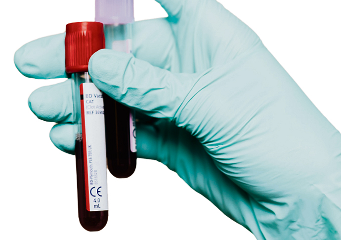 Blood test workers in pay walkout Blood test 1